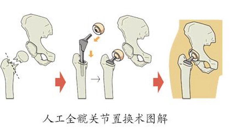 赵氏骨科：家庭医生的贴心选择